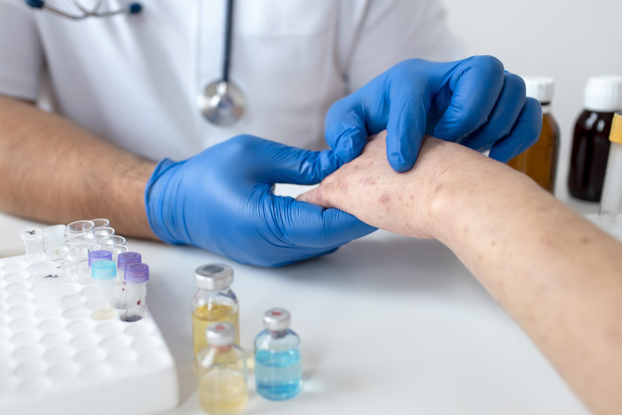 skin-allergy-person-s-arm https://ariaclinic.ro/wp-content/uploads/2025/01/skin-allergy-person-s-arm-scaled.jpg